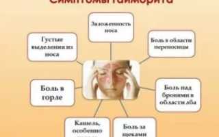 Кашель после гайморита