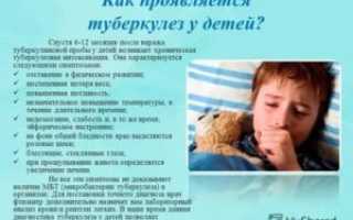 Признаки туберкулеза у детей до года