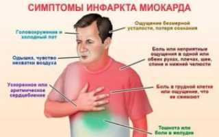 Одышка после инфаркта миокарда лечение