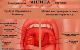 Можно ли в баню если болит горло