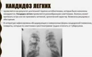 Кандидоз легких лечение