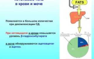 Кетоновые тела в крови
