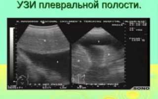 Узи плевральных полостей методика проведения