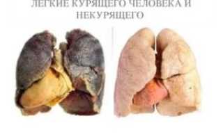 Легкие курящего человека и некурящего