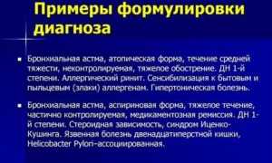 Формулировка диагноза бронхиальная астма