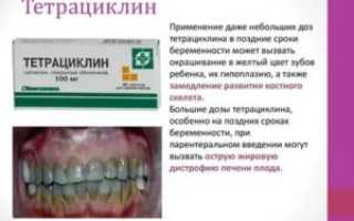 Тетрациклин при беременности