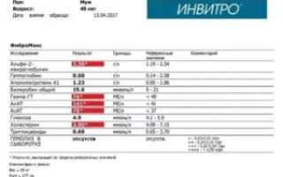 Анализ крови на коклюш в инвитро