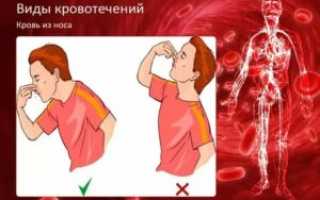 Как остановить кровь из головы
