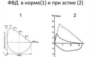 Фвд при бронхиальной астме показатели