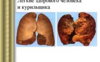 Рентген легких курильщика и здорового человека