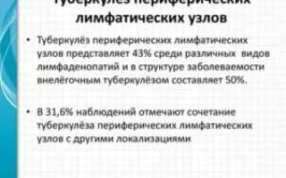 Туберкулез периферических лимфатических узлов