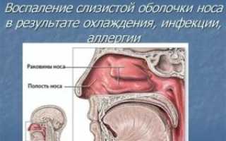 Воспаление слизистой оболочки носа лечение