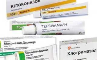 Белые пигментные пятна