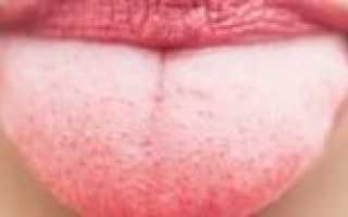 Красные прыщики на языке ближе к горлу