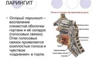 Воспаление связок горла лечение
