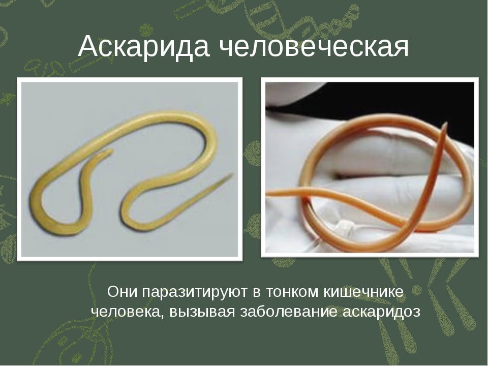 Как проявляются нематоды у человека?