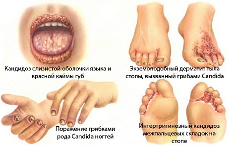 Особенности