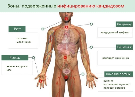 Возможные симптомы