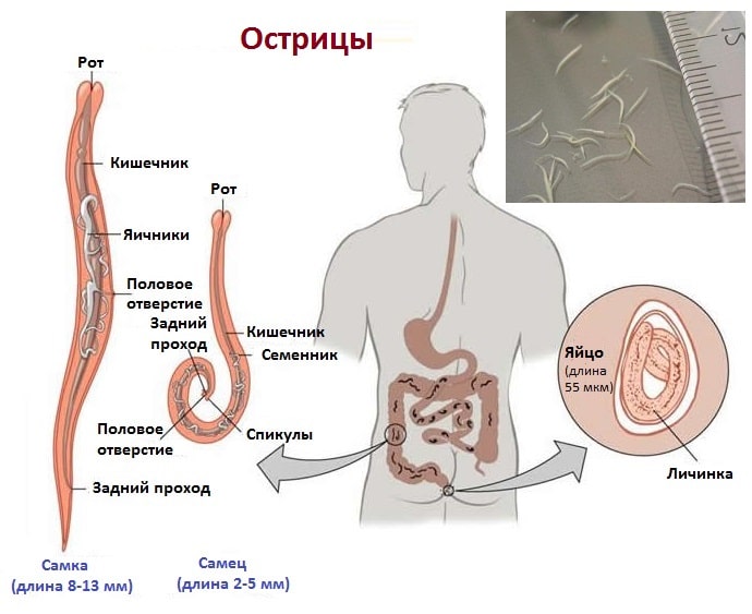 Какие встречаются паразиты в желудке у человека
