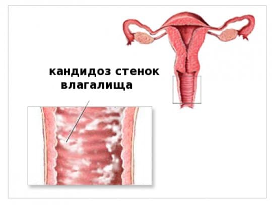 Признаки
