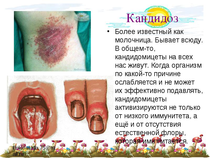 Виды